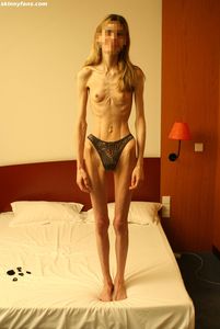 Fotos] Anorexic And Young Skinny Girls! - Page 3